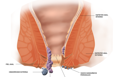 Sigue estos 7 consejos para prevenir las hemorroides