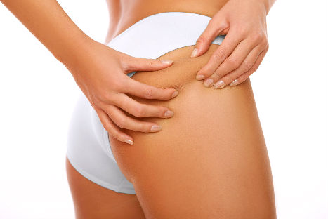 5 alimentos que ayudan a reducir la celulitis