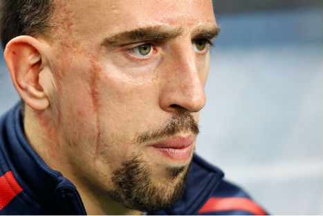 Lamentable: Ribery se lesionó y se pierde el mundial
