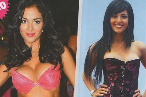 Descubre cómo lucían las modelos más conocidas antes de las cirugías-FOTOS