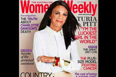 Mujer que sufre quemaduras fue elegida para salir en la portada de una revista