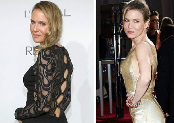 Renee Zellweger luce irreconocible tras numerosas cirugías (FOTOS)