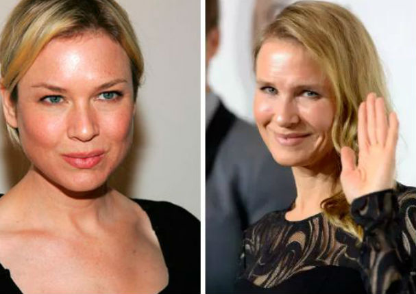 Renee Zellweger luce irreconocible tras numerosas cirugías (FOTOS)