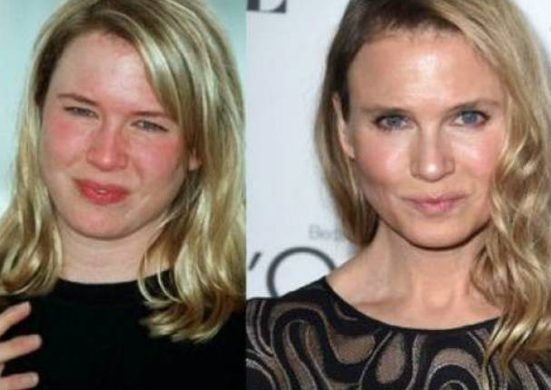 Renee Zellweger luce irreconocible tras numerosas cirugías (FOTOS)