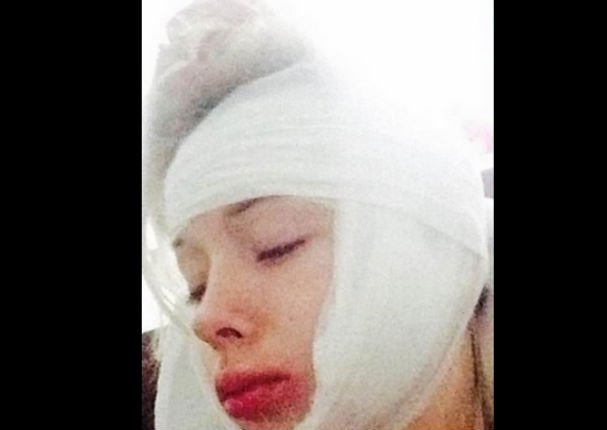 Conoce el verdadero rostro de 'la Barbie humana' (FOTOS)