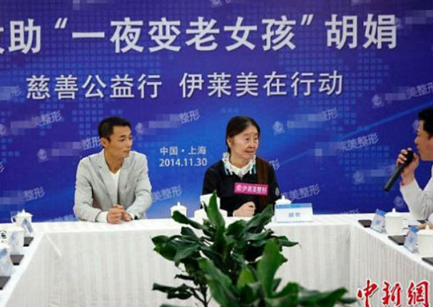 China: Mujer de 29 años luce como de 80 debido a extraña enfermedad