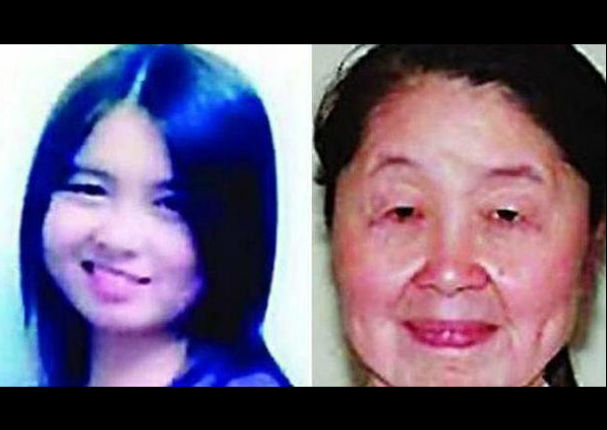 China: Mujer de 29 años luce como de 80 debido a extraña enfermedad