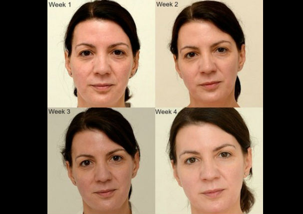 Mujer logró rejuvenecer bebiendo 3 litros de agua al día (FOTOS)