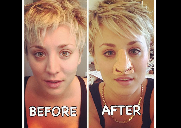 Mira cómo luce Kaley Cuoco antes y después de su cirugía de nariz (FOTOS)