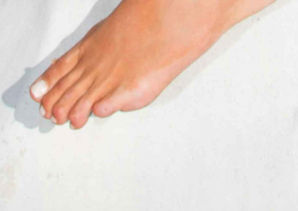 Conoce el pequeño defecto físico de la Miss Universo (FOTOS)