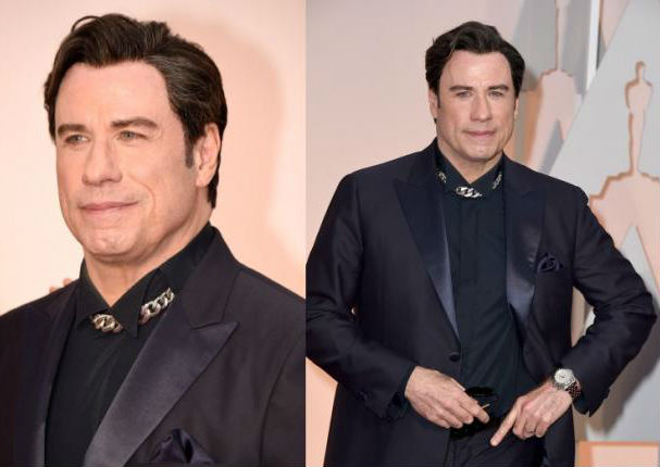¿Qué le pasó a John Travolta en el rostro? (FOTOS) ¿Qué le pasó a John Travolta en el rostro? (FOTOS)
