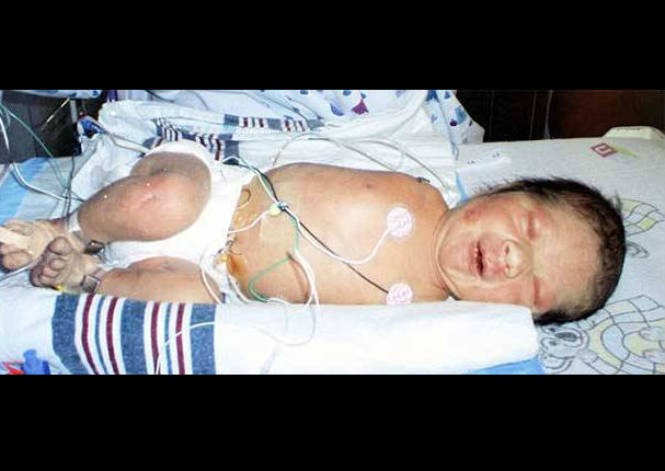 Conoce la valiente historia de una madre e hijo que nacieron sin brazos (FOTOS)