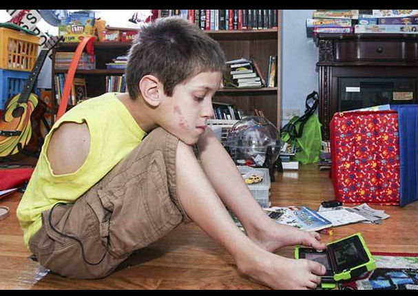 Conoce la valiente historia de una madre e hijo que nacieron sin brazos (FOTOS)