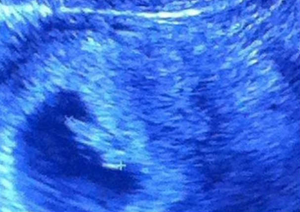 Allisson Lozz espera su segundo bebé (FOTOS)