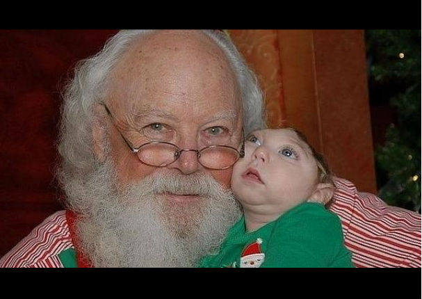 Él es Jaxon Strong, el pequeño con medio cerebro que conoció a Santa Claus