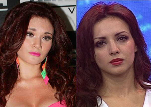 Verano Extremo: Estas son las heridas que dejó Génesis Tapia a Rosángela Espinoza - FOTOS