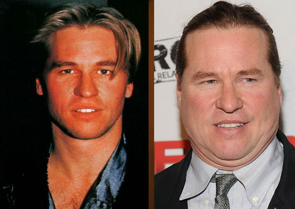 ¡Terrible! 11 famosos que abusaron del botox y las cirugías (FOTOS) ¡Terrible! 11 famosos que abusaron del botox y las cirugías (FOTOS)