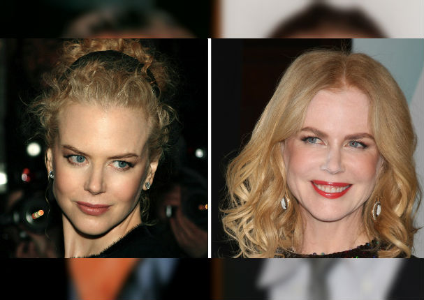 ¡Terrible! 11 famosos que abusaron del botox y las cirugías (FOTOS) ¡Terrible! 11 famosos que abusaron del botox y las cirugías (FOTOS)