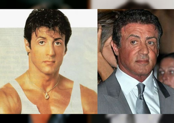¡Terrible! 11 famosos que abusaron del botox y las cirugías (FOTOS) ¡Terrible! 11 famosos que abusaron del botox y las cirugías (FOTOS)