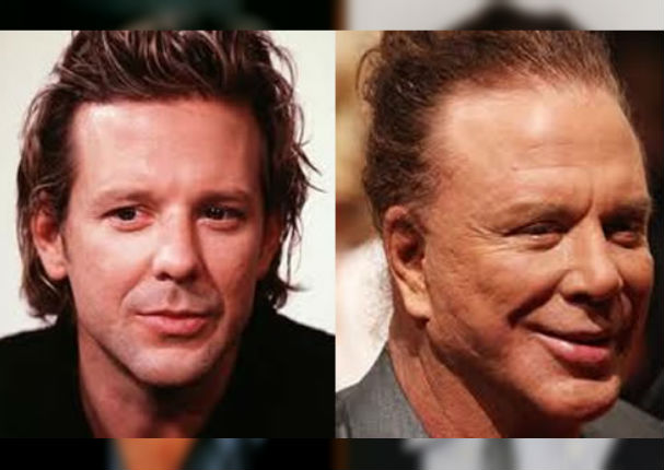 ¡Terrible! 11 famosos que abusaron del botox y las cirugías (FOTOS) ¡Terrible! 11 famosos que abusaron del botox y las cirugías (FOTOS)
