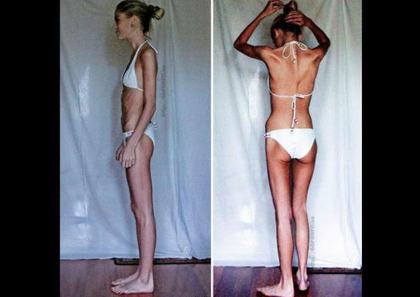 Instagram: Ella luchó contra la anorexia y ahora luce increíble (FOTOS) Instagram: Ella luchó contra la anorexia y ahora luce increíble (FOTOS)