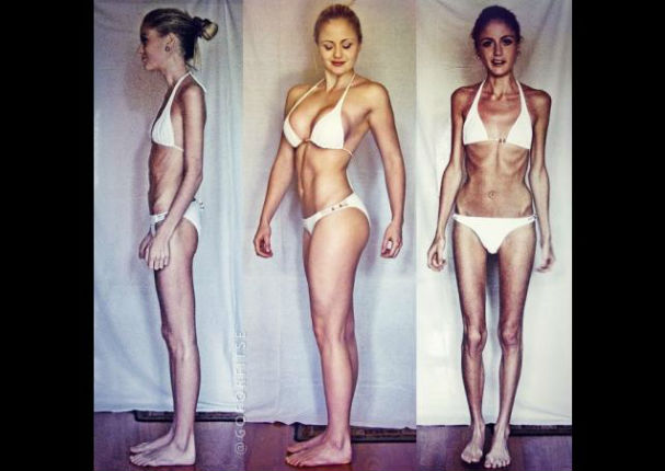Instagram: Ella luchó contra la anorexia y ahora luce increíble (FOTOS) Instagram: Ella luchó contra la anorexia y ahora luce increíble (FOTOS)
