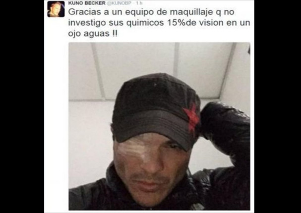 Actor de Primer amor a 1000 x hora pierde visión en un ojo