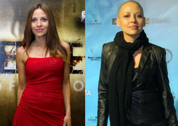 Actriz de TV Azteca lucha contra el cáncer y pide dinero mediante rifas