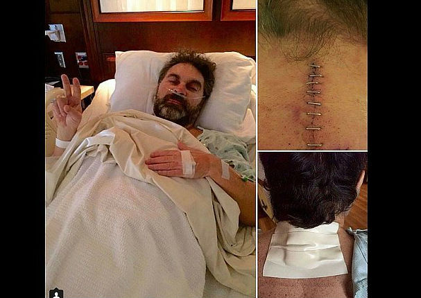 Manuel Mijares se sometió a delicada cirugía cervical (FOTOS) Manuel Mijares se sometió a delicada cirugía cervical (FOTOS)
