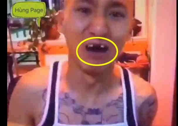 Faceboook: ¡Comió choclo con un taladro y sus dientes quedaron así! - VIDEO
