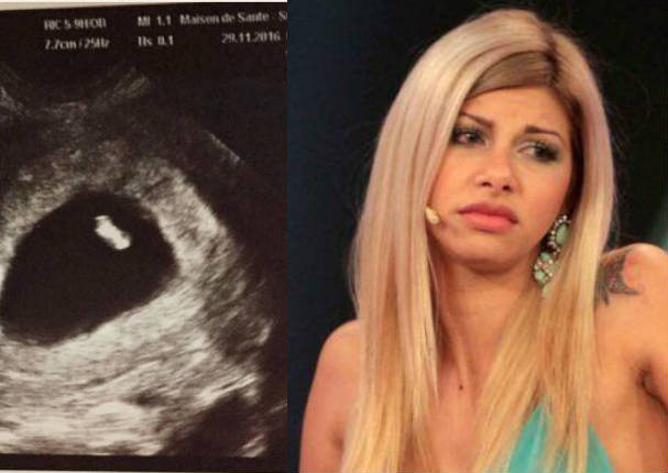 Xoana González reveló que estaba embarazada - FOTO