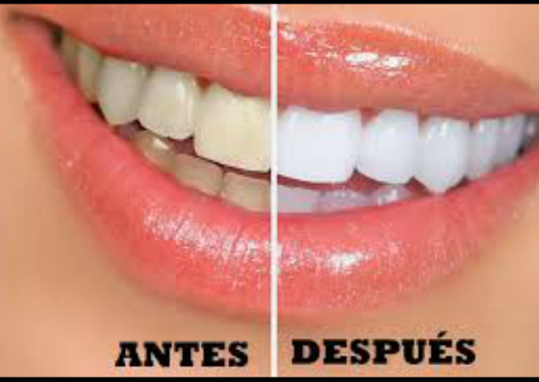 YouTube: ¡Blanquea tus dientes en 2 minutos!