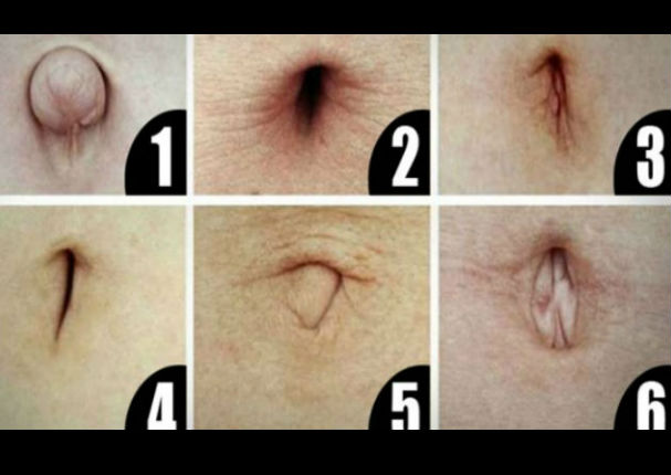 Viral: La forma de tu ombligo delataría esta enfermedad ¡Alerta!