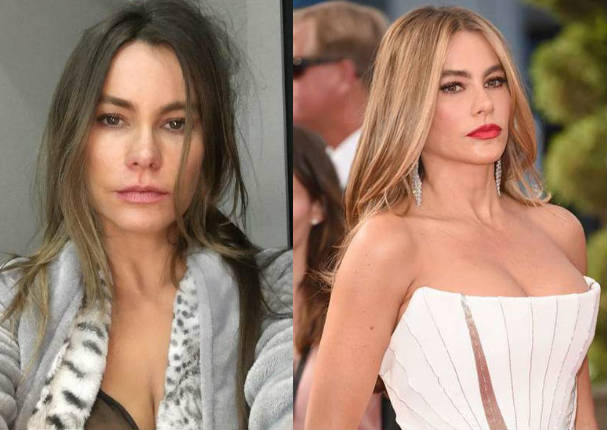 Sofía Vergara preocupa a seguidores por su actual estado de salud - FOTO