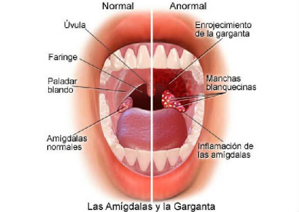 ¡Increíble! Calma la picazón de garganta con este delicioso truco