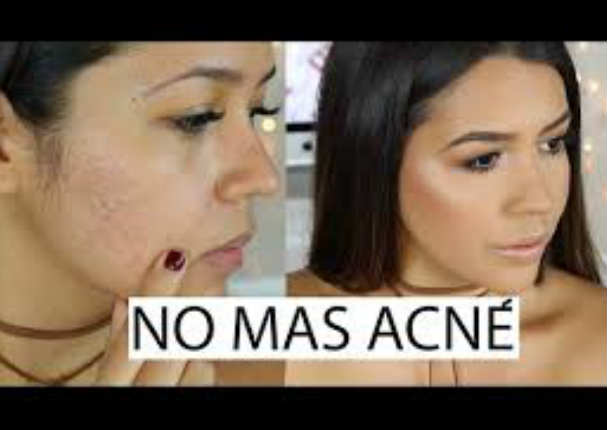 ¡Cómo una profesional! Así podrás cubrir el acné con maquillaje - VIDEO