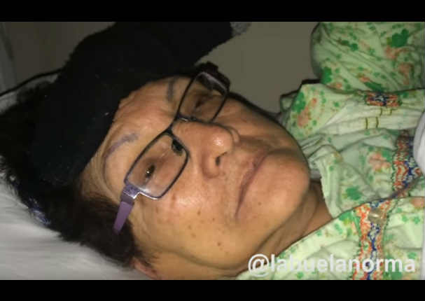 'La Abuela Norma': Ladrones se llevaron sus ahorros tras ser internada en hospital