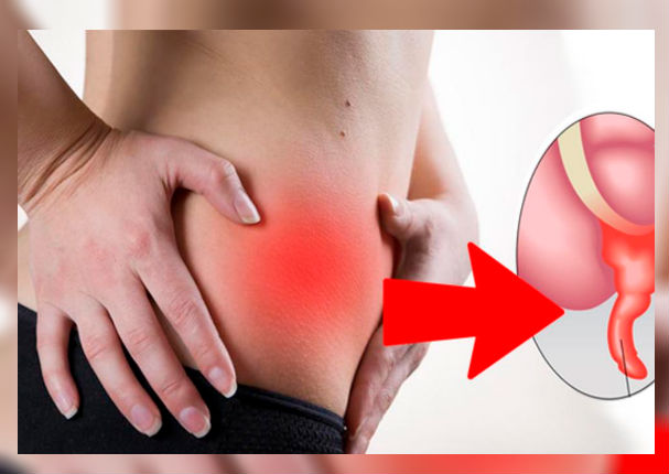 Aprende a reconocer los síntomas de la apendicitis