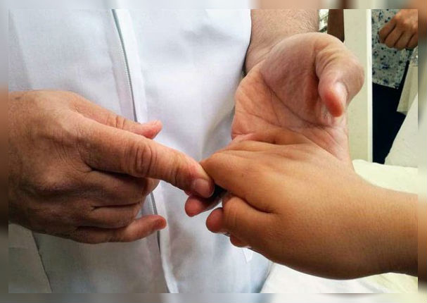Niños con deformaciones congénitas podrán ser operados totalmente gratis