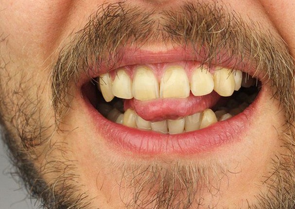 Hombre corta su lengua para detener el avance del coronavirus